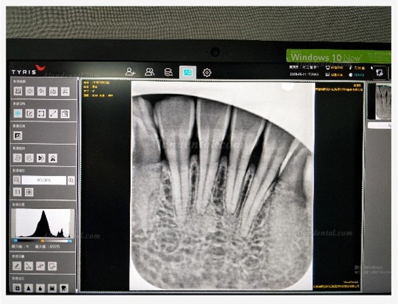 TYRIS TR-100 Dental Intraoral CR Imaging Plate Scanner PSP X ray Scanner